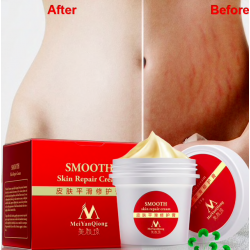 Stretch marks & scars removal repair body creamMassage